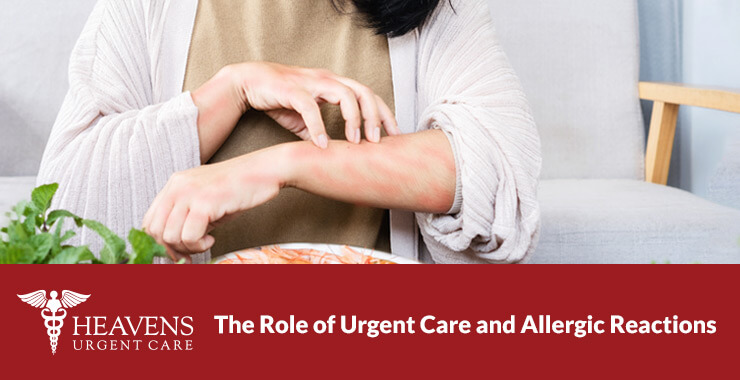 Can you go to urgent care for an allergic reaction