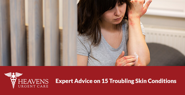 Woman with skin condition on her arm