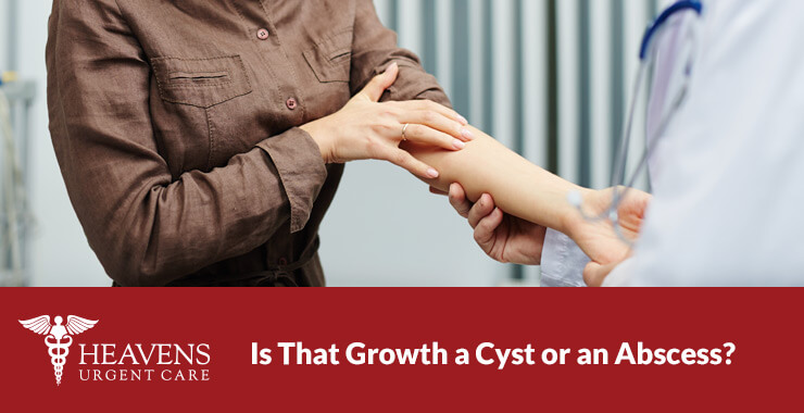 Cyst or Abscess - woman getting her arm inspected by a physician