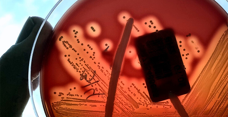 Strep bacteria in a petri dish