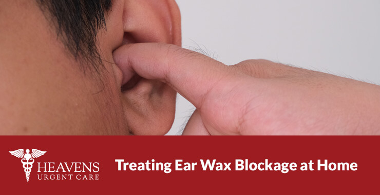 Treating Ear Wax Blockage from Home
