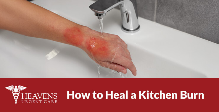 How to heal a kitchen burn. Arm with water from faucet running over